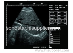SS-7 Portable Ultrasound Machine PriceLaptop Ultrasound Scanner