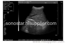 SS-7 Portable Ultrasound Machine PriceLaptop Ultrasound Scanner