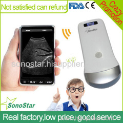 Sonostar Android & IOS system ultrasound scanner mini ultrasound machine UProbe-2