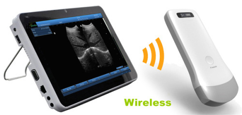 Sonostar manufacturer supplies portable wireless wifi ultrasound probe for sale