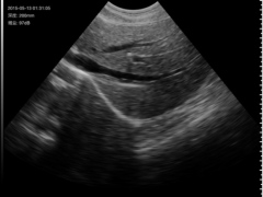 Sonostar manufacturer supplies portable wireless wifi ultrasound probe for sale