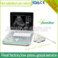 Sonostar cheapest portable ultrasound machine device veterinary ultrasound SS-7 / V7