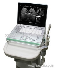 Sonostar cheapest portable ultrasound machine device veterinary ultrasound SS-7 / V7