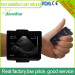 V2 Veterinary Wrist Ultrasound Scanner SonoStar V2 h Pregnant Diagnosis