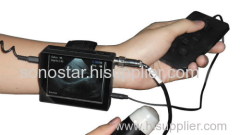 V2 Veterinary Wrist Ultrasound Scanner SonoStar V2 h Pregnant Diagnosis