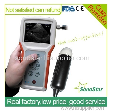 V1 h Veterinary Handheld Ultrasound Scanner SonoStar V1 h