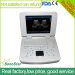 Sonostar good quality handheld portable vet ultrasound scanner pig veterinary ultrasound V10(SS-10V )