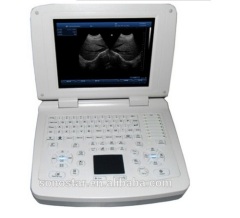 Sonostar good quality handheld portable vet ultrasound scanner pig veterinary ultrasound V10(SS-10V )