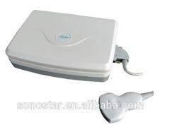 Sonostar good quality handheld portable vet ultrasound scanner pig veterinary ultrasound V10(SS-10V )