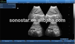 Sonostar good quality handheld portable vet ultrasound scanner pig veterinary ultrasound V10(SS-10V )