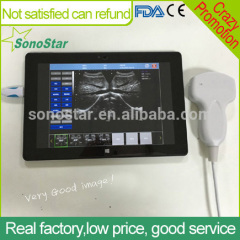 UPad-10V PC based tablet Vet ultrasound scanner