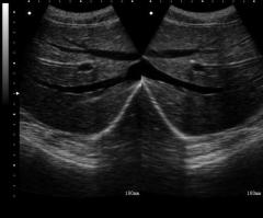UPad-10V PC based tablet Vet ultrasound scanner