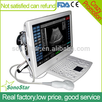 V8 Veterinary LCD Ultrasound Scanner ultrasoni black white scanner SonoStar