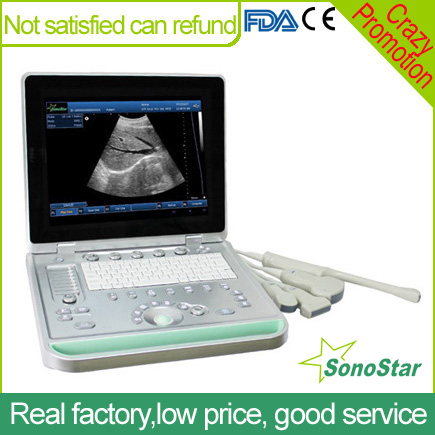 V9 Veterinary Laptop Ultrasound B scanner(ultrasound ultrasoni black white scanner) SonoStar