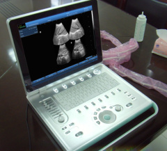 V9 Veterinary Laptop Ultrasound B scanner(ultrasound ultrasoni black white scanner) SonoStar