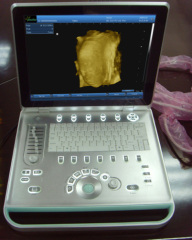 V9 Veterinary Laptop Ultrasound B scanner(ultrasound ultrasoni black white scanner) SonoStar