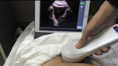 Sonostar new 3D 4D laptop ultrasound scanner ipad ultrasound scanner for sale BProbe-2