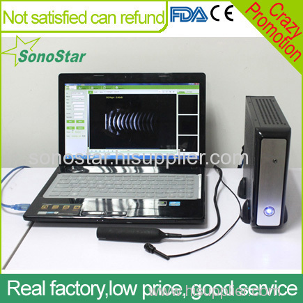 SAB-200 Advanced Digital Ophthalmic Scanner Ultrasound Scanner Sonostar
