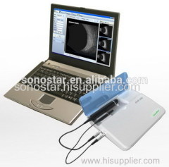 SAB-200 Advanced Digital Ophthalmic Scanner Ultrasound Scanner Sonostar