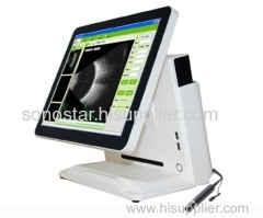 SAB-500 Opthalmic A/B scanner A/B ultrasound scanner for eyes