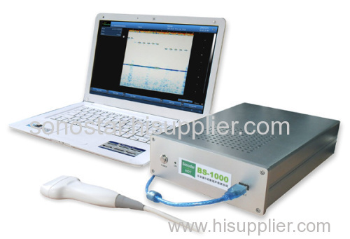BS-1000 ultrasound box B imaging inspect imaging system(NDT ultrasonic B scan)
