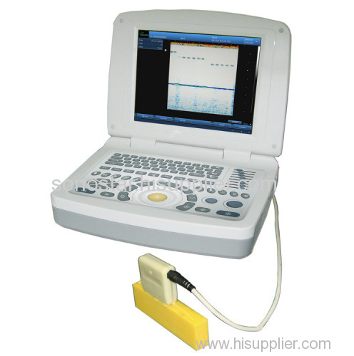 BS-2000 B scan inspect imaging system (NDT ultrasonic ultrasound B image scan)