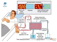 Auxin Plus Dialysis Solutions