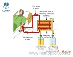 Auxin Plus Haemodialysis Concentrate