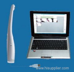 Wired Intra oral camera dental equipment