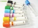 China CE certificate factoey price vacuum blood collection tube