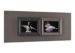 Horizontal Two Openings 4x6 Collages Photo Frame In Dark Gray and Middle Gray Colors