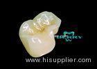 Porcelain Dental Inlays Or Onlays Distinguished and Honorable no any allergy Glass