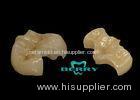 Durable Zirconia Composite Inlays Excellent and Nature Appearance