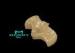 FDA Dental Inlay Salvage Small Surface Defect of Nature Tooth