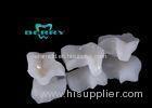 Current Porcelain Inlays And Onlays Salvage the Small Surface Defect Nature Tooth