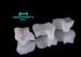 Current Porcelain Inlays And Onlays Salvage the Small Surface Defect Nature Tooth