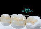 Composite Dental Inlays distinguishing choiced to restore small surface damage