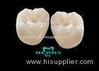 High Noble Palladium-Silver Composite Dental Veneers without discoloration