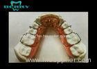 Spring Splint Material Different Orthodontic Appliances Difficult to Clean