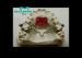 Nanc and overarm Ring Types Of Orthodontic Appliances Plastic Tray Material