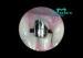 PFM In Dentistry No Any Poisonous Side Effect Pure Titanium Dental Post and Core