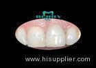 Gold composite Captek Nanogold crowns restoration better gingival health