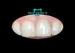 Gold composite Captek Nanogold crowns restoration better gingival health
