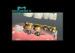 Intensity Restoration Captek Bridge Captek Naogold Dental Crowns