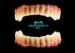 ISO13485 BioHpp Crown Bridge Perfect Luxury Fixing Restorations