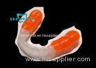 Beautiful Sports Mouthguards for Athletes Important Precaution