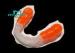 Beautiful Sports Mouthguards for Athletes Important Precaution