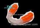Beautiful Sports Mouthguards for Athletes Important Precaution