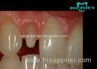 FDA Ceramic Dental Crowns Restoration Good Biocompatibility