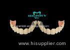 Implantable Telescope Crown restoring your perfect mouth state